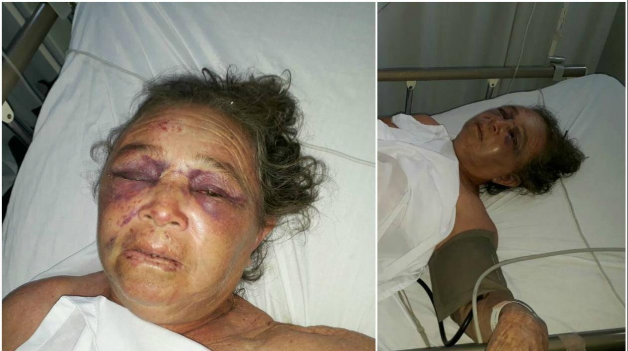 La anciana está siendo atendida en una clínica de Barranquilla, debido a los golpes.