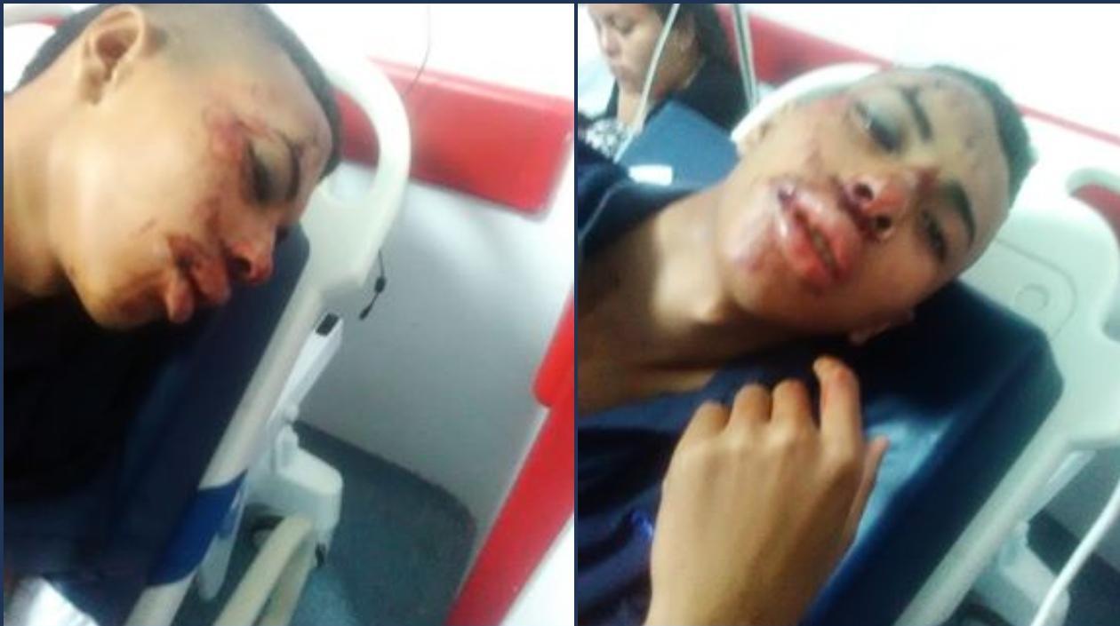 Dayro Andrade Muñoz, hincha de 16 años, agredido por hinchas violentos de Millonarios.