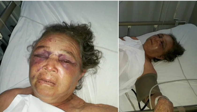 La anciana está siendo atendida en una clínica de Barranquilla, debido a los golpes.