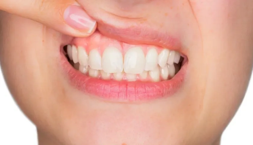 El lavado de los dientes después de comer es una de las recomendaciones de los odontólogos.
