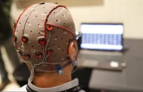 Imagen de archivo de un tratamiento cerebral